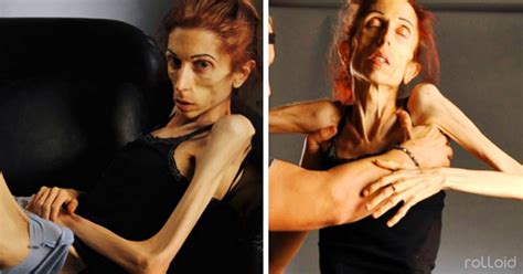 9 Imágenes De La Transformación De La Actriz Que Ganó A La Anorexia