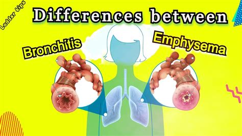 Differences Between Bronchitis And Emphysema Biology Ladder Tips