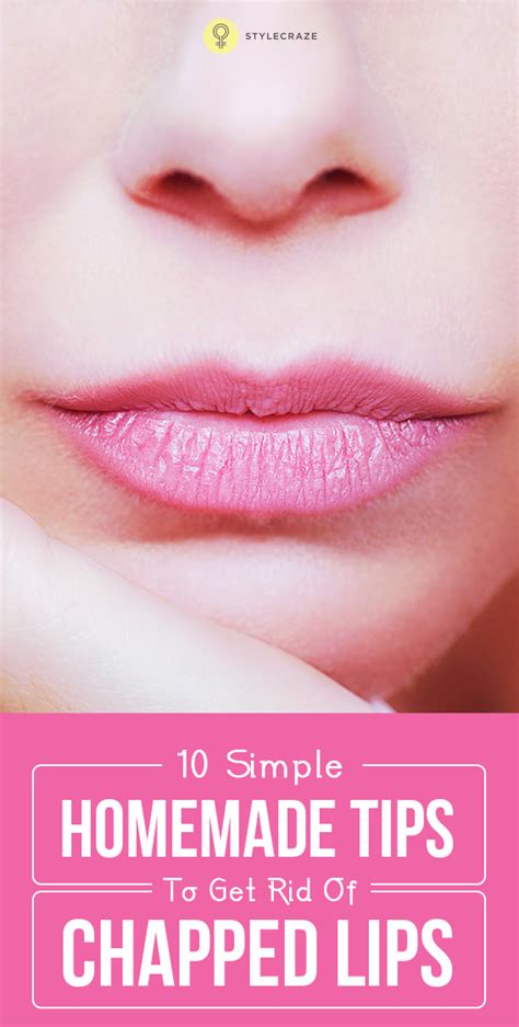 10 Simple Home Remedies To Get Rid Of Chapped Lips