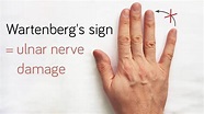 Wartenberg’s Syndrome - EMG NCV
