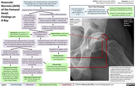 Avascular Necrosis Avn Of The Femoral Head Findings On X Ray