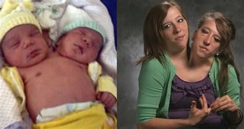 30 interesting things about famous conjoined twins abby and brittany hensel worldemand