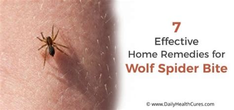 7 Home Remedies To Treat Wolf Spider Bite Daily Health Cures