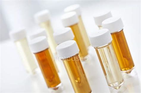 Urine Samples Stock Photos Royalty Free Images Focused