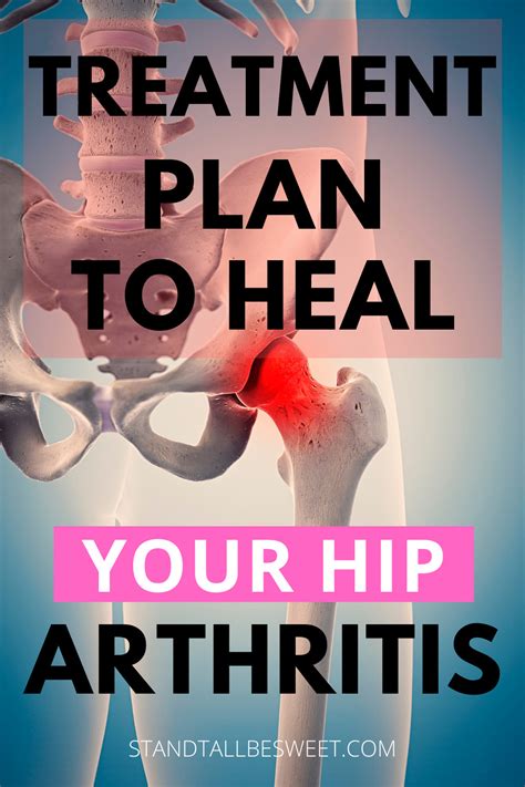 Treatment To Heal Hip Arthritis Stand Tall Be Sweet