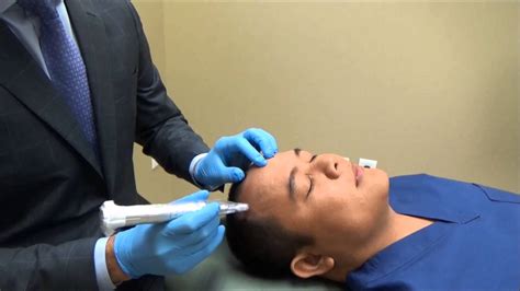 Definitive guide on microneedling, including the procedure overview, benefits, risks, recovery microneedling, also called collagen induction therapy, percutaneous collagen induction, involves the. Microneedling For Hair Loss Results