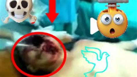 Face Split Accident Video Original Goresee Death Is Watching Over You