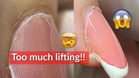 Lifting Overload French Nails Acrylic Fill Youtube