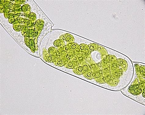 Botany Filamentous Algae What Exactly Am I Looking At Biology