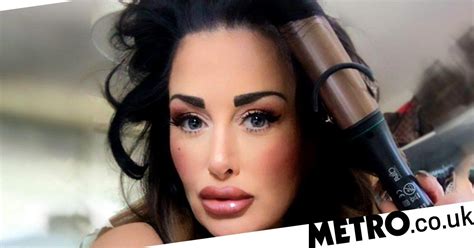 Mum Has Plastic Surgery To Value Of £100000 To Look Younger In Sussex