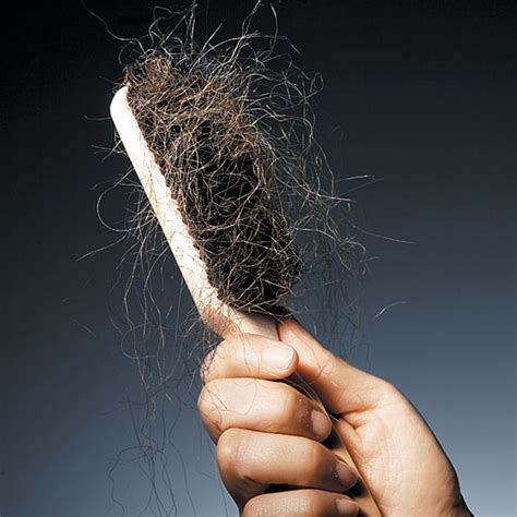 Does Hair Shedding Play A Role In Hair Loss Modena Hair Institute