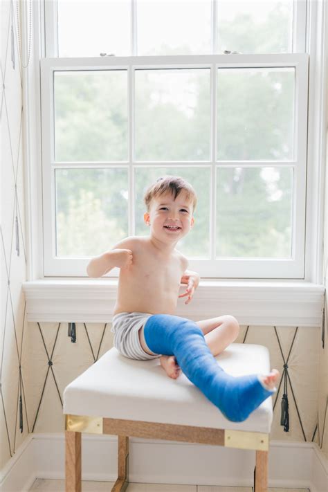 Tips For Surviving A Toddler Broken Leg Happily Eva After