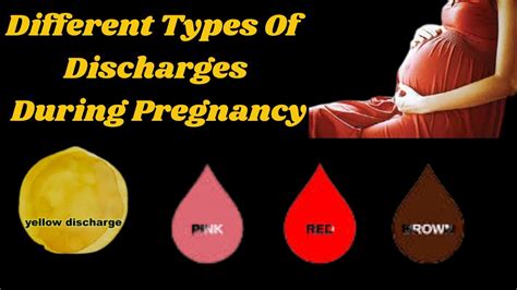 Discharge During Pregnancy White Discharge Brown Dischargecreamy