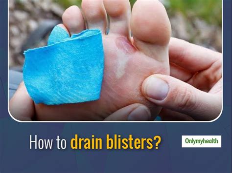 How To Drain A Blister Core Plastic Surgery