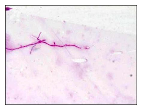Gram Positive Thin Long Beaded Branching Filaments Of Nocardia