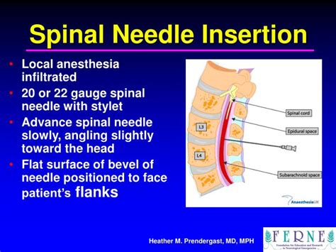 Ppt Lumbar Puncture Indications And Procedure Powerpoint