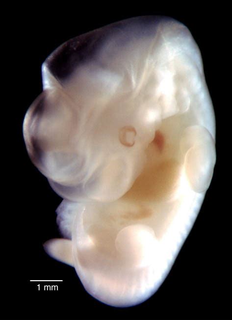 Multi Dimensional Human Embryo Result Page
