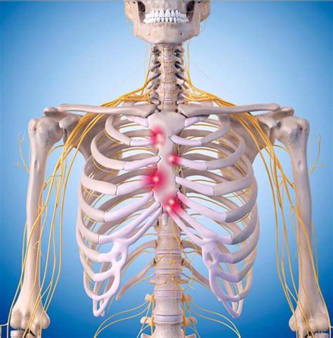 Anatomy Of Chest Pain