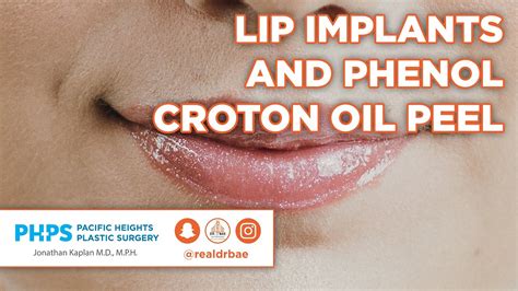 Lip Implants Phenol Croton Oil Peel Pacific Heights Plastic
