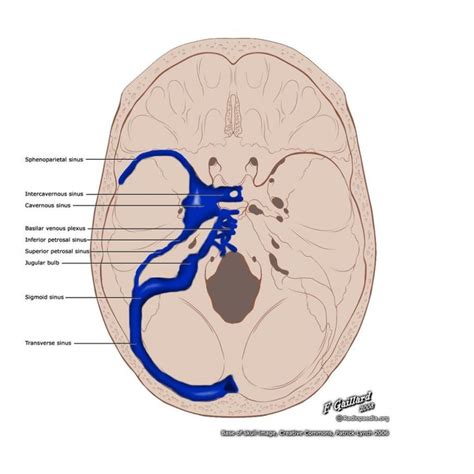 Dural Venous Sinuses Illustration Radiology Case Radiopaedia Org