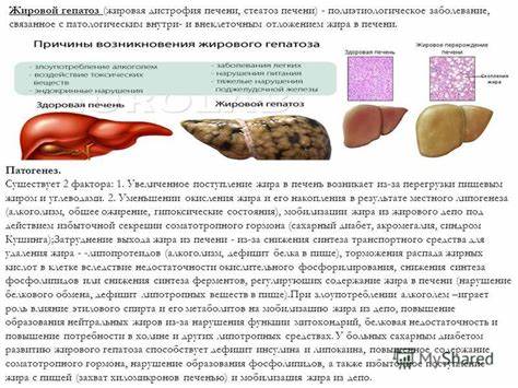 Диета при жировой дистрофии печени Жировой Гепатоз Симптомы Лечение Диета — Похудение Диета Правильное Питание Жировой Гепатоз Симптомы Лечение Диета — Похудение Диета Правильное Питание Диета при жировой дистрофии печени