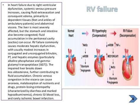 Figure 1 From Pathophysiology Of Acute Heart Failure Syndrome A