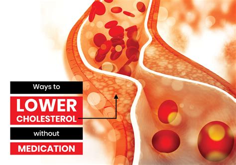 Ways To Lower Cholesterol Without Medication Multicare Pharmacy