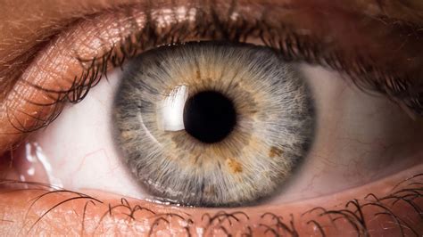 What will cause the black dots? 5 eye symptoms you should never ignore - TODAY.com