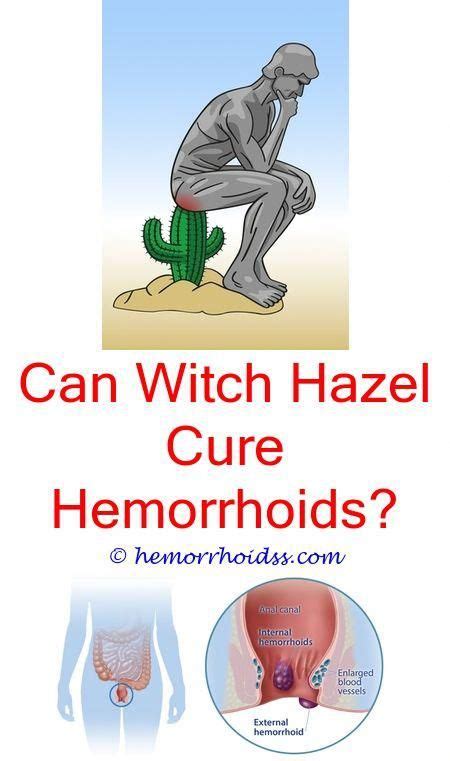 How To Treat A Large Hemorrhoid How Often Do Internal Hemorrhoids