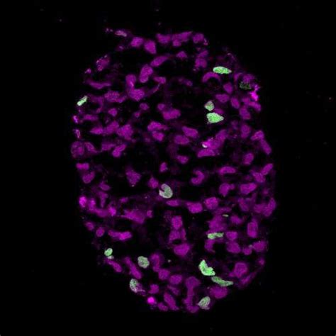 Egg And Sperm Race Scientists Create Precursors To Human Egg And Sperm In The Lab