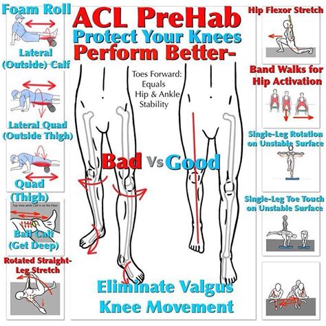The Diagram Shows How To Perform An Acl Prehabb And Prevent Your Knees
