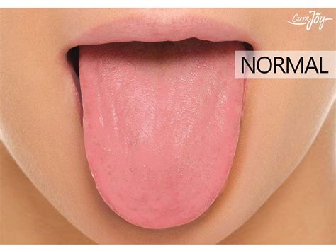 What Your Tongue Says About Your Health Tongue Health Healthy Tongue