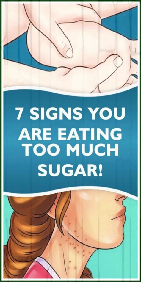 7 Signs Youre Eating Too Much Sugar The Effects Of Too Much Sugar In