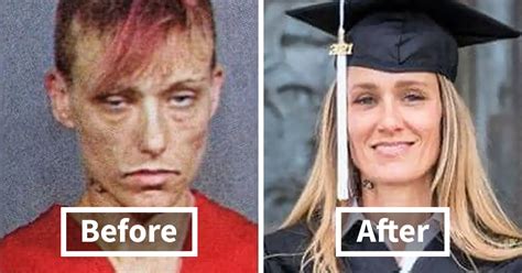 Inspiring Transformation Stories Of People Who Overcame Drug Addiction Demilked