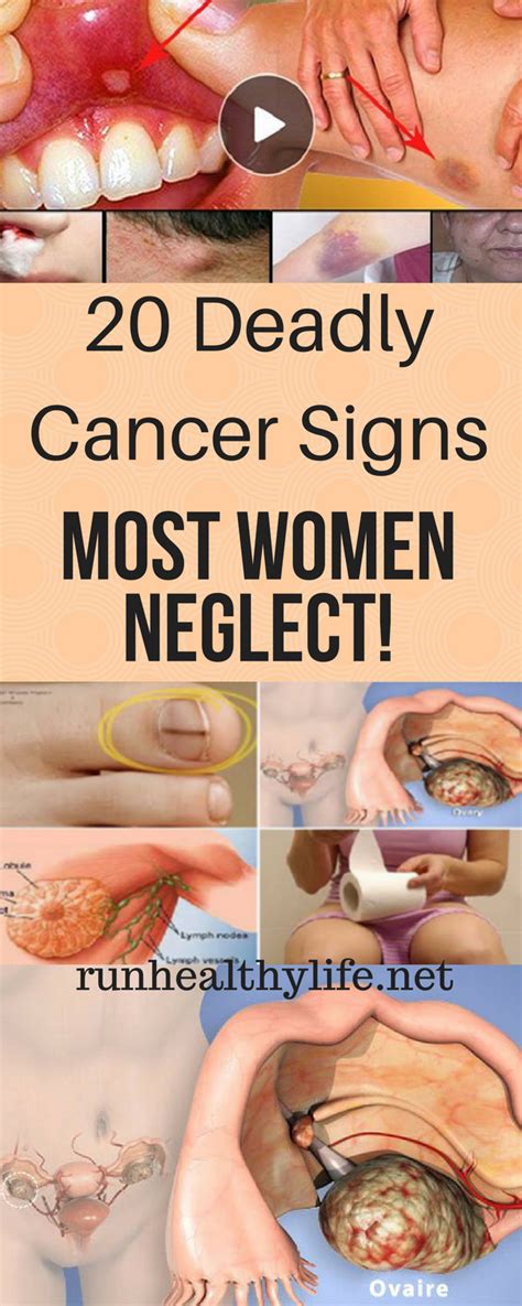 Daily Health Advisor 20 Deadly Cancer Signs Most Women Neglect