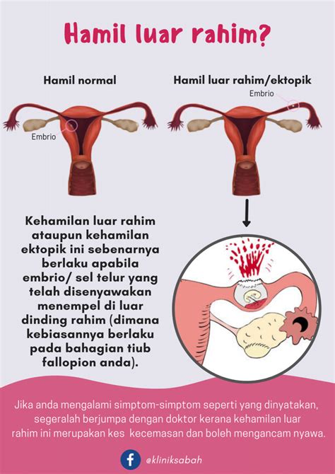 Pasalnya, organ ini berperan penting sebagai tempat pembuahan prosedur kesehatan tertentu juga menjadi penyebab susah hamil padahal haid lancar. Bahaya hamil luar rahim : Risiko dan gejala - Klinik Sabah