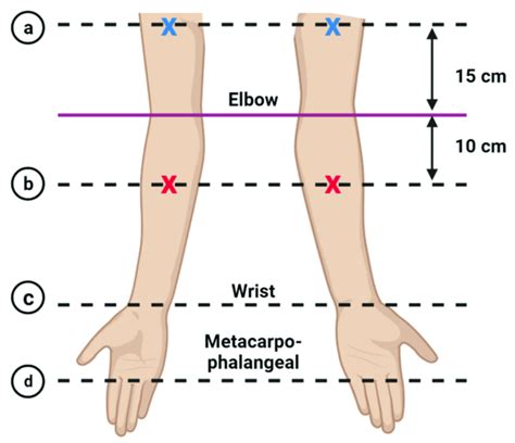 Points Of The Arm Circumference Measurement Performed On The Study