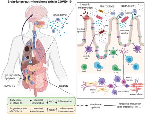 Gastrointestinal Symptoms Associated With Covid 19 Impact On The Gut