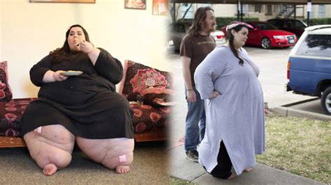 Morbidly Obese Woman Loses Half Her Body Weight After Hitting 292 Kilos