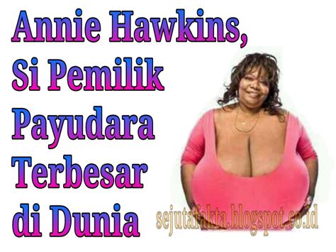 Annie Hawkins Si Pemilik Payudara Terbesar Di Dunia Sejuta Fakta