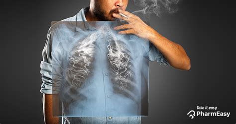 7 Health Effects Of Smoking On Body And Mind Pharmeasy