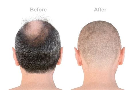 Shaving My Head Was An Experience Investors Can Learn From Heres How