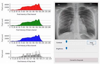 Histogram Medical Data Distribution Visualize Charts Expose