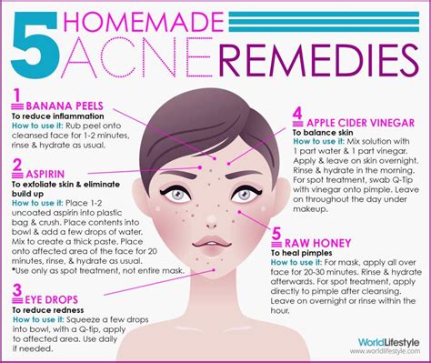 Say Goodbye To Acne The Natural Way Cavsconnect