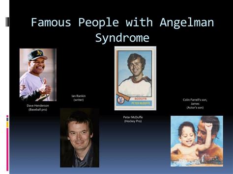 Ian Rankin With Angelman Syndrome Acne Symptoms