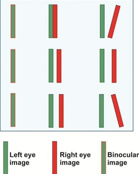 Diplopia Double Vision Physiological And Pathological Optography