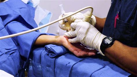 Regenexx Regenerative Orthopedic Treatments For Hand Arthritis