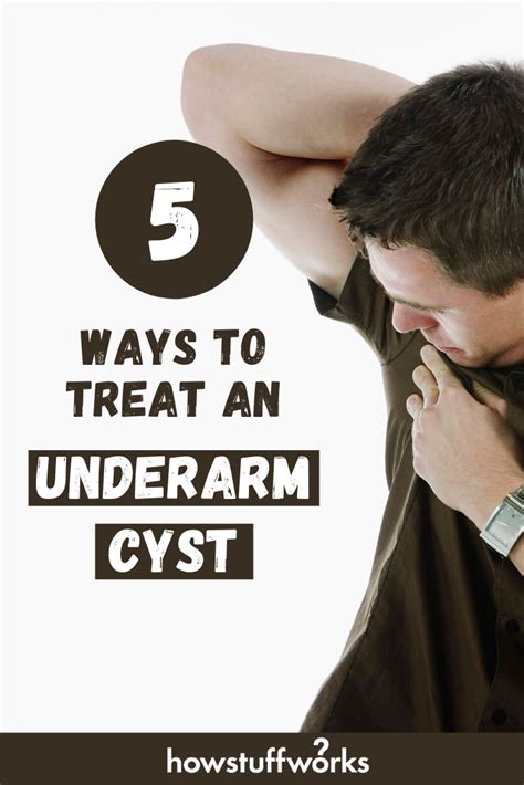 Quick Tips 5 Ways To Treat An Underarm Cyst Cysts 5 Ways Underarm