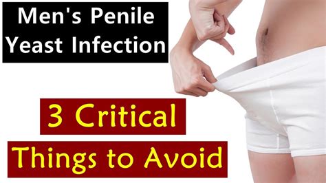 Men S Penile Yeast Infection 3 Critical Things To Avoid Youtube