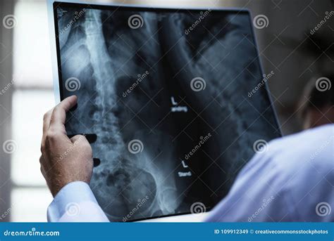 Person Holding X Ray Film Picture Image 109912349